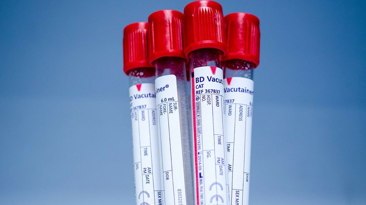 Claves para detectar la leucemia linfocítica crónica